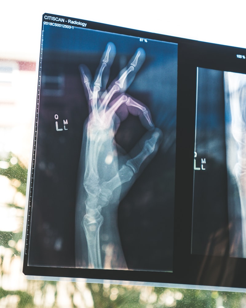 3D Printed Scaffolds